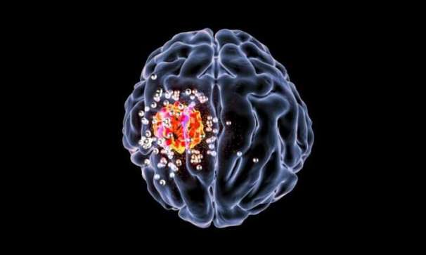 tiny brain nanoparticles 1-tinynanopart